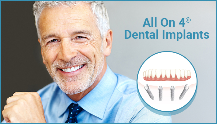 ALL ON FOUR DENTAL IMPLANTS