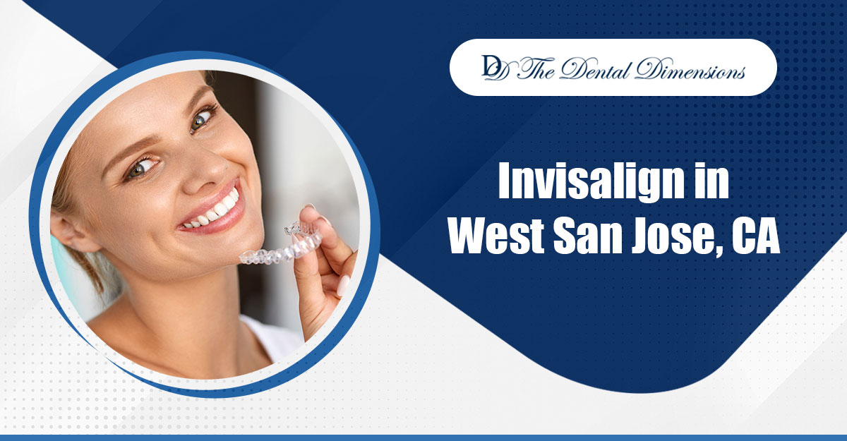 Invisalign in West San Jose