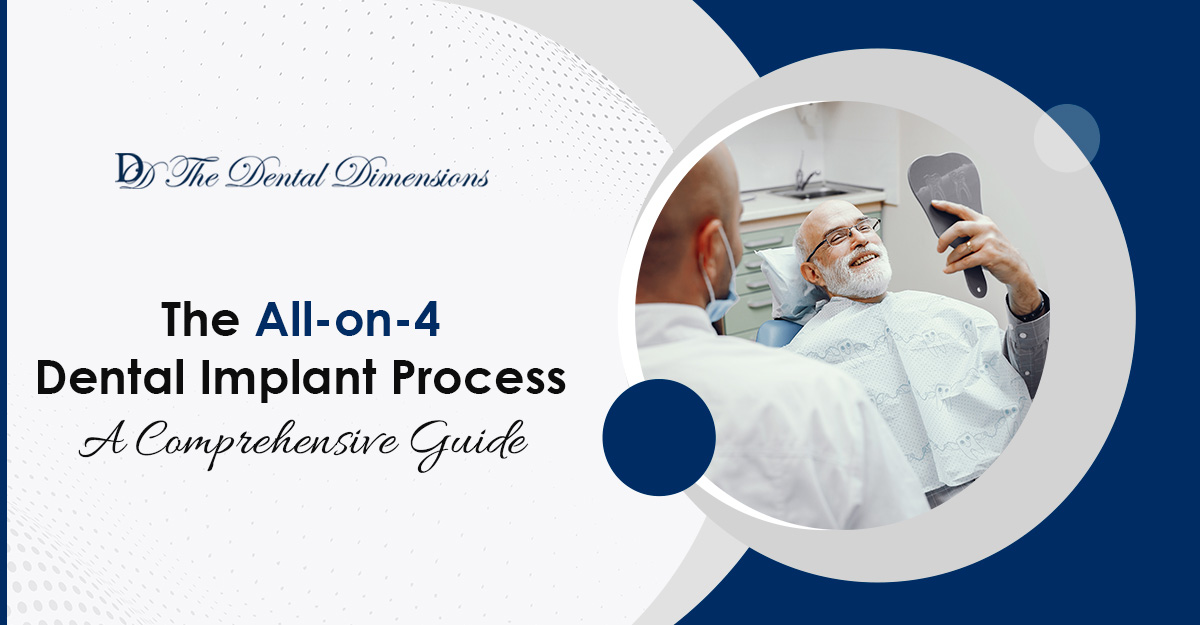 All-on-4 Dental Implant Process