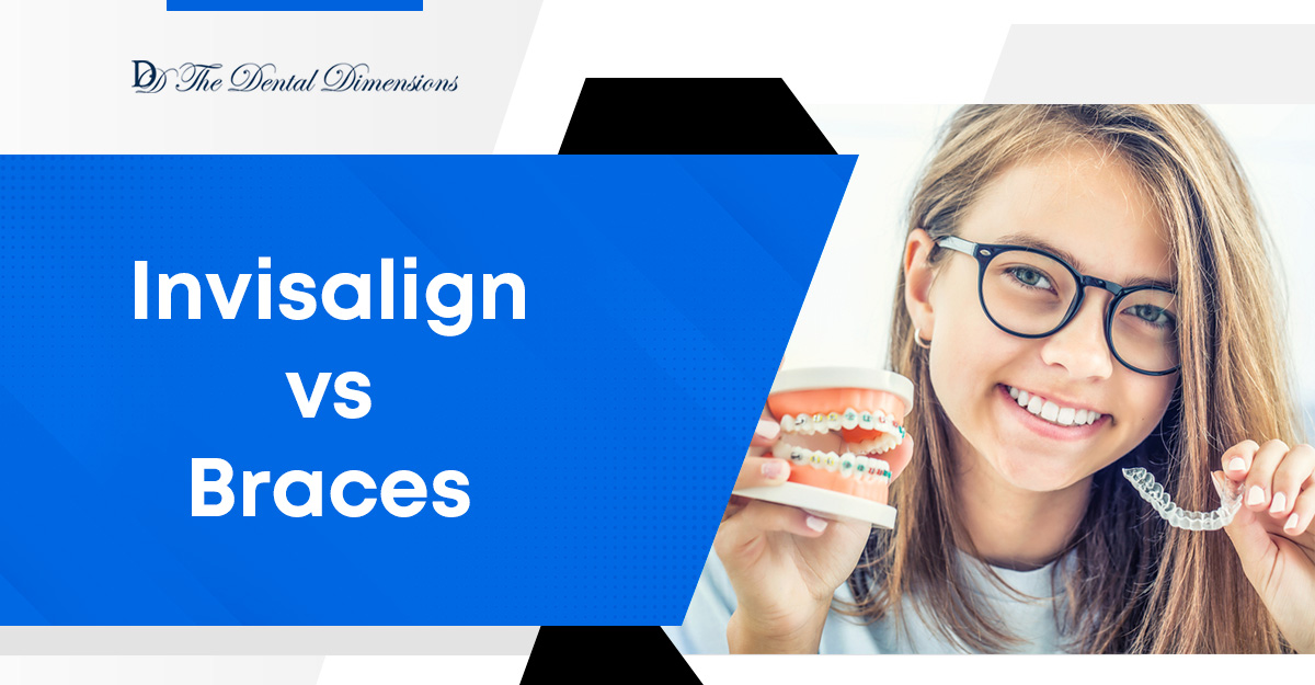 invisalign-vs-braces