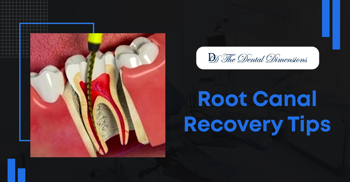 Top 10 Root Canal Recovery Tips