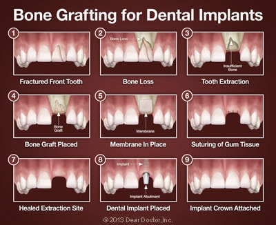 Emergency And Family Dental Clinic In San Jose | Dental Dimensions